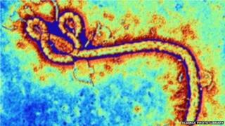 Ebola virus