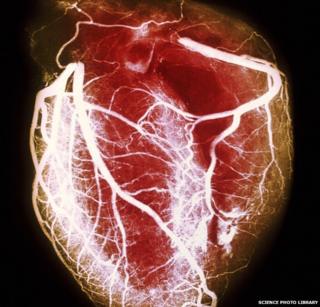 Human Heart
