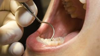 Tooth decay