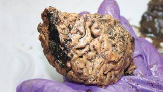 Brain found near York