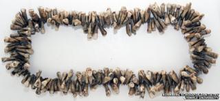 Necklace of teeth