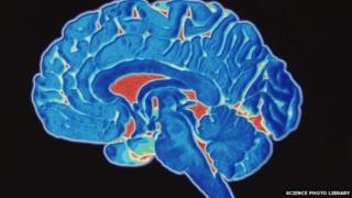 Brain scan