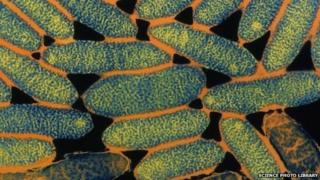 A close up of the legionella bacteria