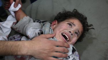 A wounded Syrian child is treated at a makeshift clinic after a reported Syrian government strike on Kafr Batna, in the besieged rebel-held Eastern Ghouta (22 February 2018)