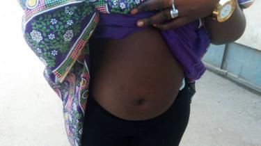 Woman with swollen stomach