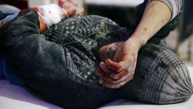 Paciente ensanguentado em hospital na Síria