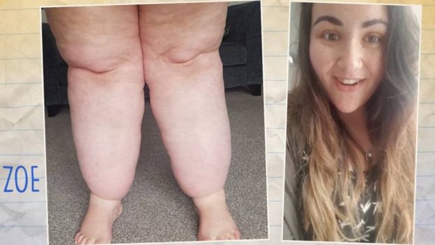 Zoe y sus piernas
