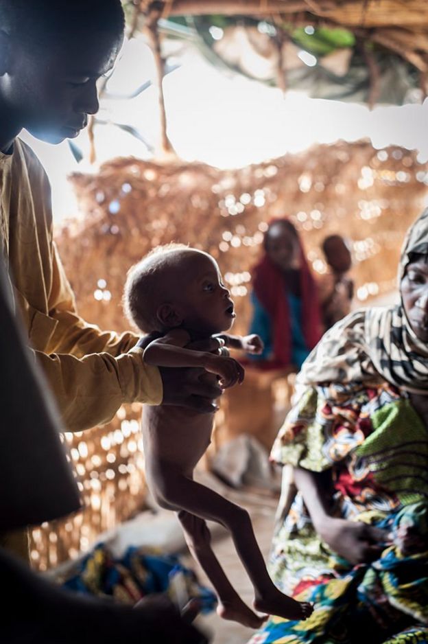 Niño con inanición en Nigeria