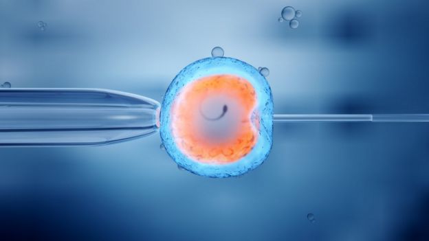 Ilustración de una inseminación artificial