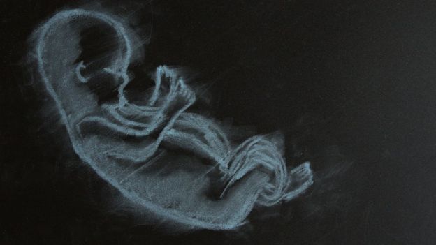 Un feto dibujado en un pizarrón