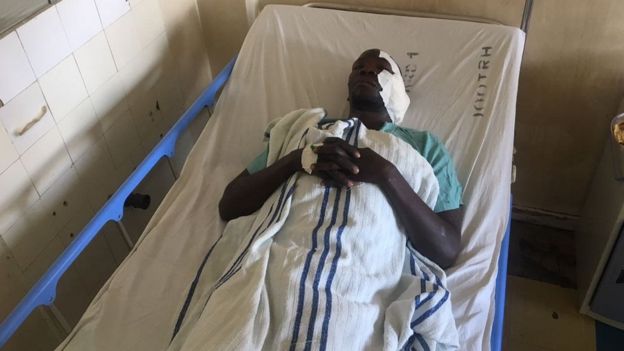 David Okoth Maina mwenye umri wa mika 32 alipigwa risasi usoni