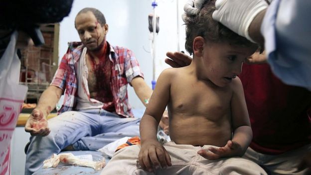 طفل يمني يتلقى العلاج في تعز بعدما جرح في سبتمبر 2015