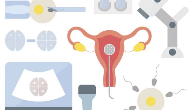 Ilustración del proceso de fertilización in vitro.