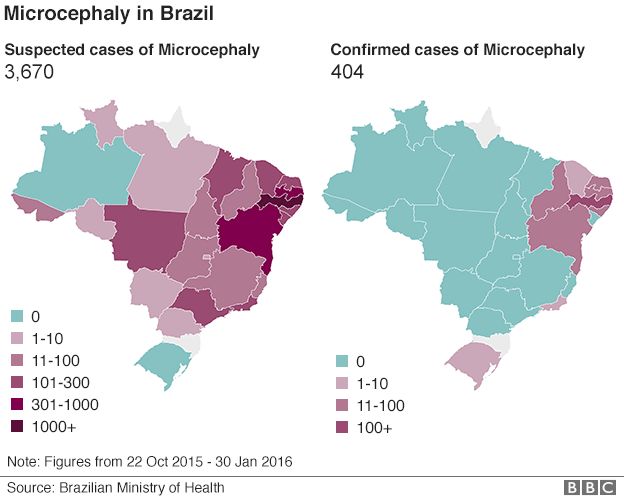 Where in Brazil is microcephaly map