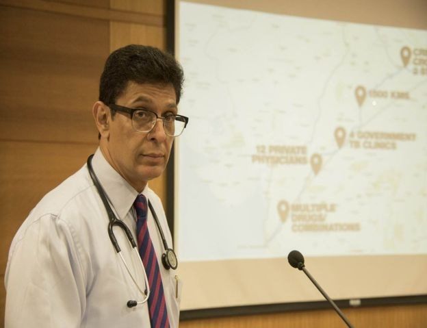 காசநோய்