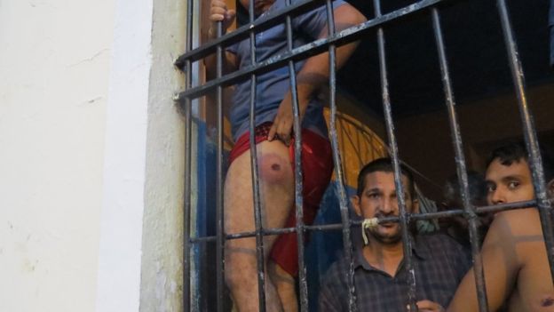Detento mostra ferida em Manaus