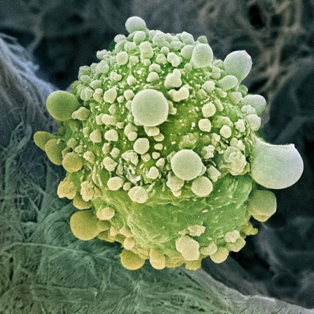 Célula de cáncer de páncreas.