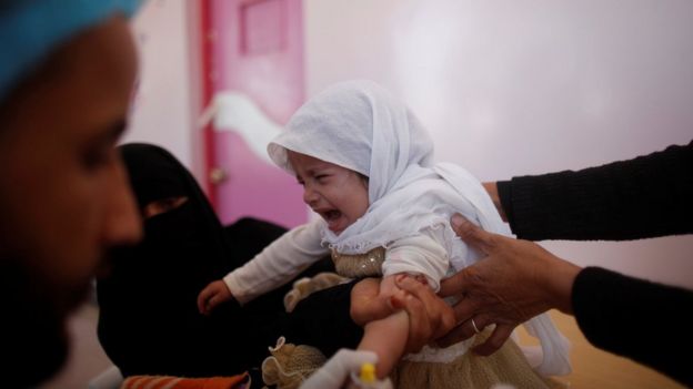A girl cries at a cholera treatment centre in Sanaa, Yemen (29 October 2016)