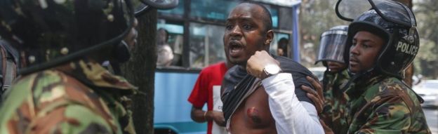 A Kenyan activist Boniface Mwangi protests against police officers as he shows his chest wounded by a tear gas canister during a demonstration against recent police brutality that killed some opposition protesters, in Nairobi, Kenya, 19 October 2017