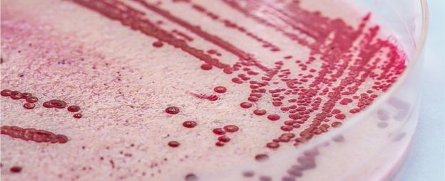 L'épidémie de listériose aurait fait au moins 180 morts au cours des quatorze derniers mois.