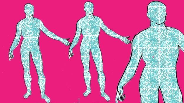 மலமாற்று அறுவை சிகிச்சை