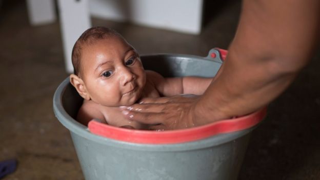 Jose Wesley in Poco Fundo, Brazil, being bathed in a bucket by his mother Solange Ferreira, December 2015