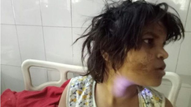 குரங்குகளுடன் வாழ்ந்ததாகக் கூறப்படும் சிறுமி