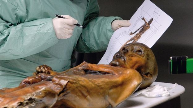 Ötzinin cesedi