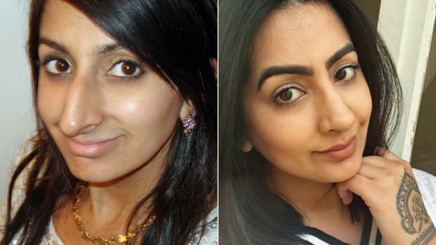 Sharon Dhaliwal, antes y después de la rinoplastia.