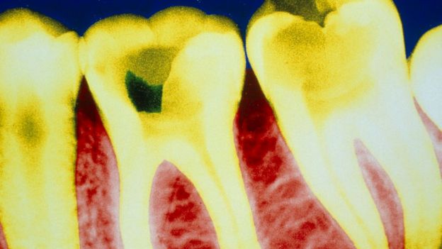 Ultimos Avances en Ciencia y Salud - Página 8 _97695359_hi007180158