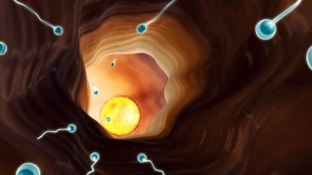 Ilustração de espermatozoides a caminho do útero
