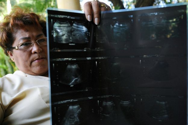 Iris Rodríguez, una víctima del "jarabe de la muerte", muestra una placa de rayos X en Ciudad de Panamá el 25 de marzo de 2009. (Foto: Elmer Martínez / AFP / Getty Images)