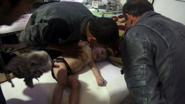 Niño herido en Siria