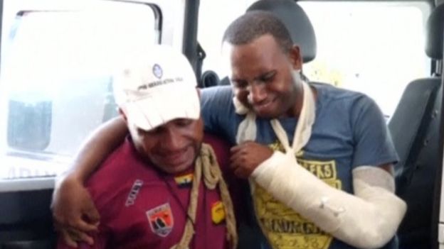 An injured man is helped into a hospital, during clashes between protesters and police in Port Moresby. Photo: 8 June 2016