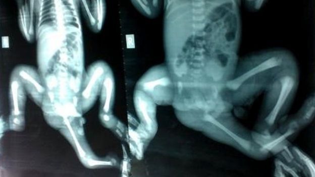 Choity'nin röntgenleri