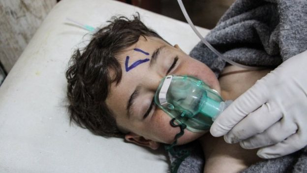 طفل يعتقد انه أصيب في هجوم كيمياوي على خان شيخون في إدلب في سوريا