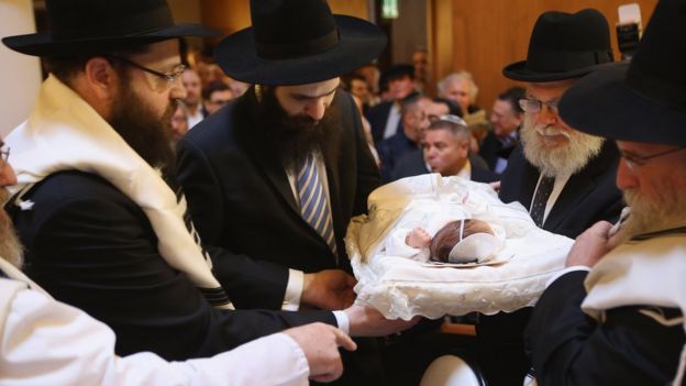 Los judíos circuncidan al niño al octavo día de su nacimiento
