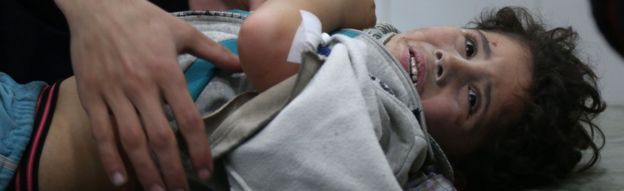 Child in hospital in Eastern Ghouta