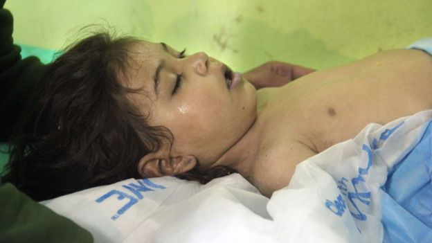 An unconscious Syrian child receives treatment at a hospital in Khan Sheikhoun, a rebel-held town in the northwestern Syrian Idlib province, following a suspected toxic gas attack on April 4, 2017