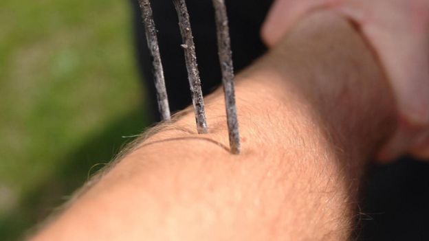 Un dispositivo de metal pinchando el brazo de una persona Foto Alamy