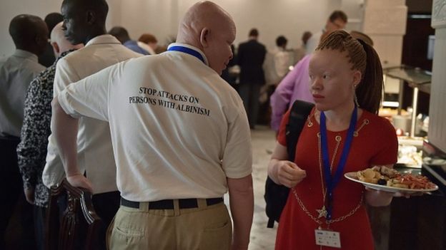 Vice President of the Albino Association of Malawi Alex Michila (L) talks to a delegate during a regional conference on albinism organised by the United Nations (UN) to discuss potential measures and legislation to protect people with albinism in Africa from discrimination and superstitious attacks, in Dar es Salaam on June 18, 2016