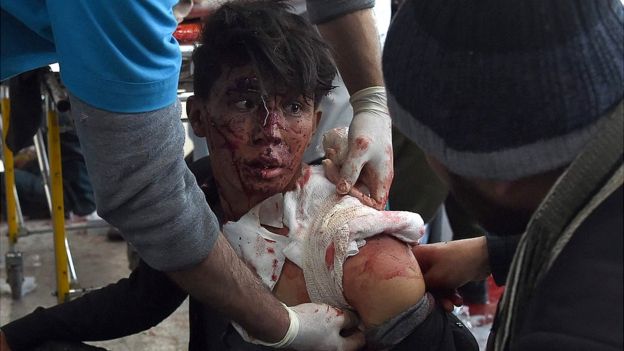 a wounded boy with blood on his face being bandaged by medical staff