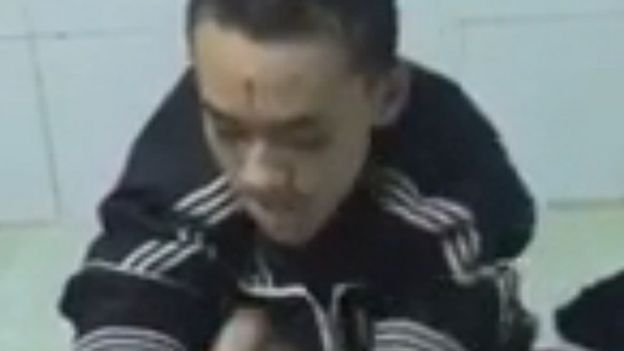 Screenshot of the man stabbing his arm