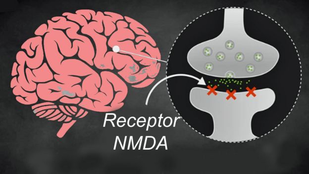 Gráfico de lo que pasa en el cerebro
