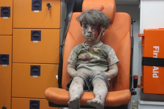 Omran Daqneesh sentado en la ambulancia tras ser rescatado