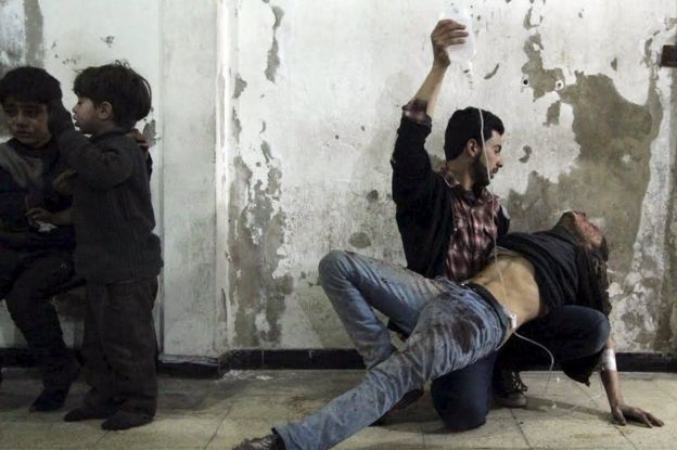 Homem assiste ferido em Damasco