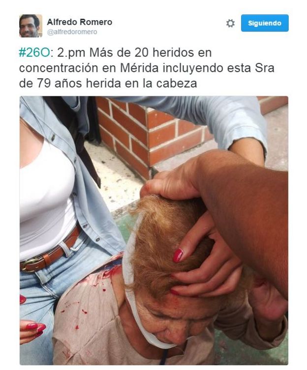 Una foto del Twitter de Alfredo Romero muestra a una señora mayor herida en la cabeza tras las protestas en Mérida, Venezuela.