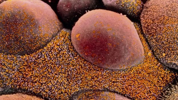 عقار جديد يقلص أورام سرطان المبيض