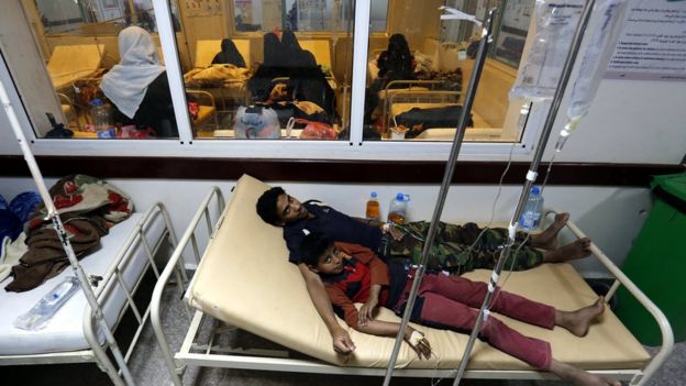 Yemeníes afectados por el cólera reciben tratamiento en un hospital de Saná, Yemen, el 14 de junio de 2017.