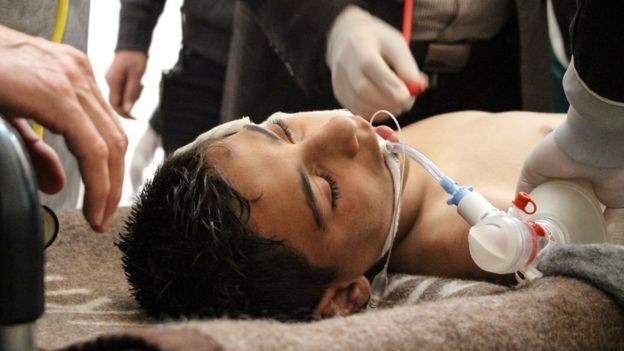 Niño sirio recibiendo tratamiento médico.